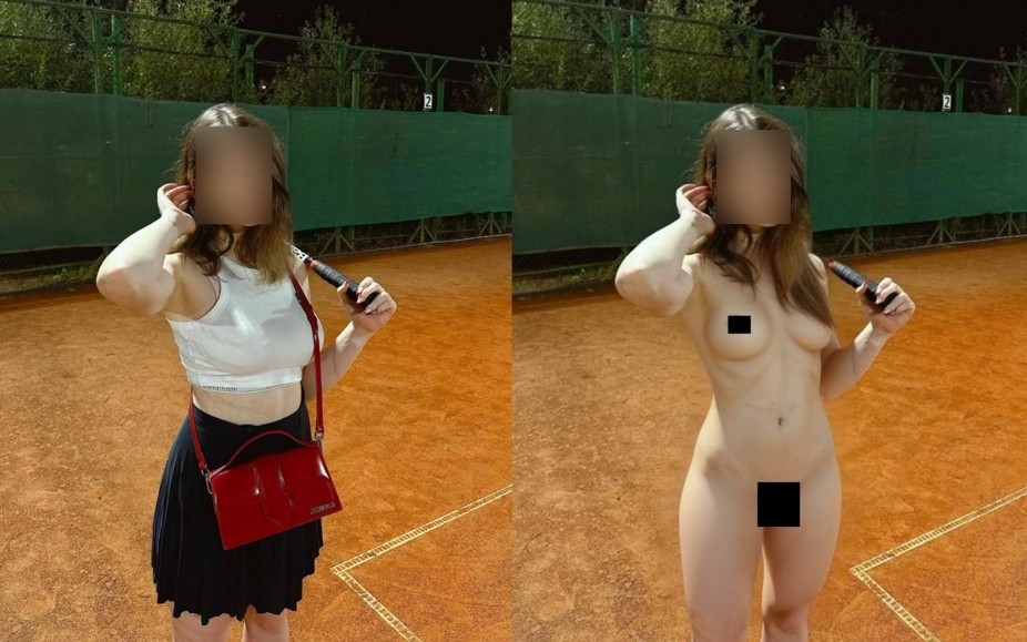 NakedVision